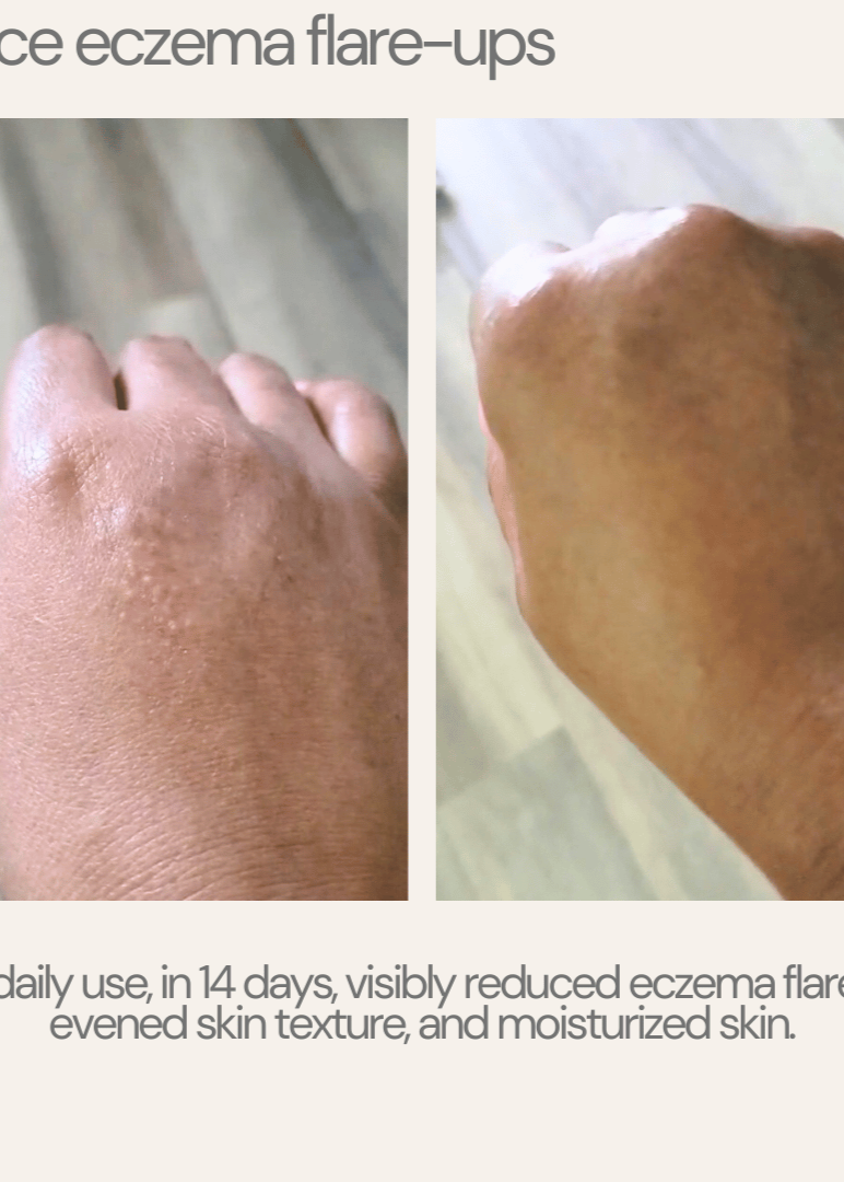 Natural Eczema Relief Oatmeal Soap