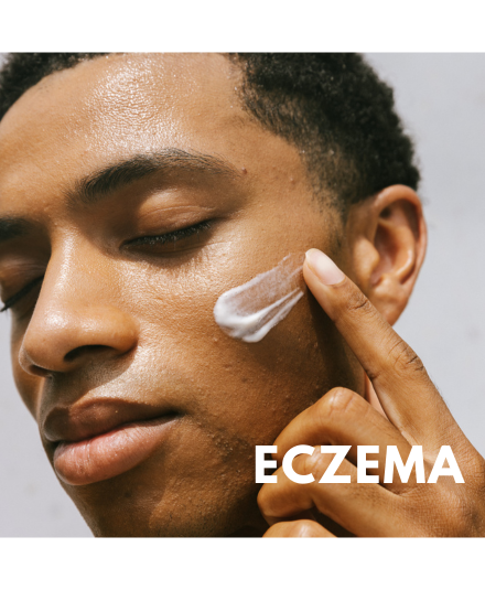 Gentle Skincare for Eczema